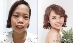 微调整形要多少钱(现在微整形要多少钱)