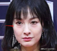 明星做了整形多少钱(艺星整容多少钱)