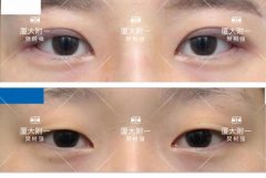 厦门整形大概得多少钱(厦门整形哪家好)