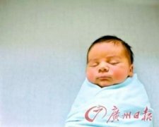 广州龅牙整形要多少钱(广州整牙齿矫正多少钱)