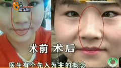 鼻子短塌整形要多少钱(鼻子塌整形需要多少钱)