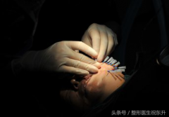 面部整形多少天不肿(整形第几天肿)