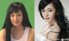 牙齿整形多少(牙齿整形多少岁)