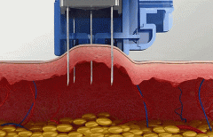 塑料粒子整形机价格多少(塑料粒子整形机价格多少钱)