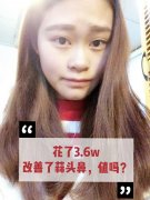 缩小鼻翼微整形多少钱(单纯缩小鼻翼大概需要多少钱)