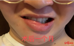 内江中医院整形科电话多少(内江整形医院有哪些)