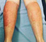 加拿大户外防晒霜品牌排行(户外加拿大品牌排行榜)