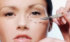 整形怎么去除眼袋多少钱(祛眼袋整形要多少钱)