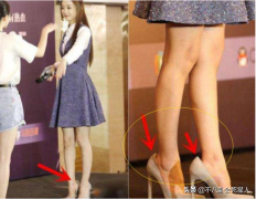 韩国脚趾整形多少钱(excel表格格式错误如何还原)