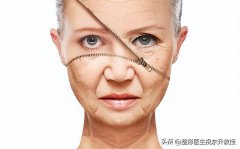 做除皱整形整形多少钱(除皱整形需要多少钱)