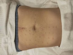 胸部整形整容多少钱(胸部整形整容多少钱啊)