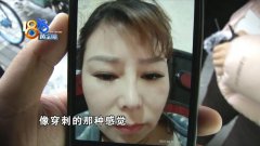 眼睛和鼻子整形多少费用(鼻部整形需要多少费用)