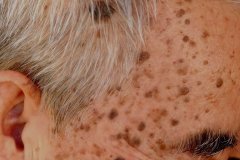 老年专用防晒霜有哪些品牌(适合老年人的防晒品牌)