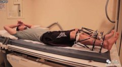 整形打眼多少钱(眼睛整形多少钱?)