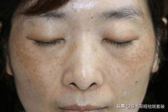 祛斑可以用的防晒霜品牌(防晒防斑什么牌子好)