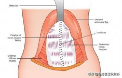 腹部整形手术疼吗多少钱(腹部整形应该去什么医院)