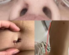 潍坊举报整形医院电话多少(潍坊附属医院整形医院地址)