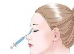 鼻子整形多少钱(鼻子整形要多少钱)