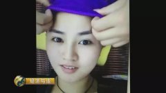 苏州下巴微整形多少钱(下颌角整容整形多少钱)