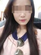 整形要多少岁才可以(做整容手术可以吗)