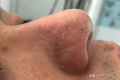 防晒霜推荐安妍科品牌(防晒霜推荐安妍科品牌)