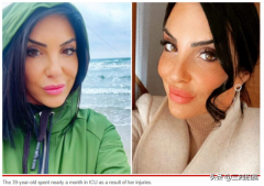 西班牙整形手术多少钱啊(意大利整形)