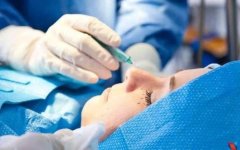 整形美容公司需要多少钱(美容整形手术多少钱)