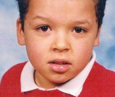 为了追星，男子花费100万元整容50多次，结果整容成了香肠嘴