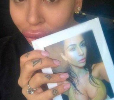 为了追星，男子花费100万元整容50多次，结果整容成了香肠嘴