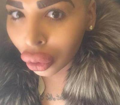 为了追星，男子花费100万元整容50多次，结果整容成了香肠嘴