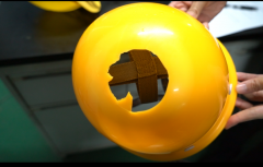 头部凹陷整形多少钱(山根凹陷整容手术要多少钱)