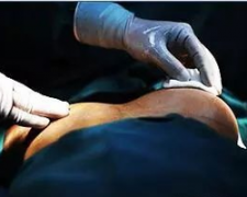 乳腺整形价格是多少费用(乳腺美容手术多少钱)