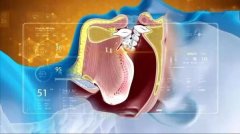 浙二整形鼻梁多少钱(浙二医院隆鼻)