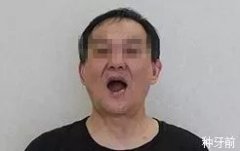 南昌医美整形带牙套多少钱(南昌医美整形带牙套多少钱啊)