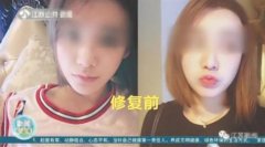 医疗整容整形鼻子多少钱(整形鼻子费用)