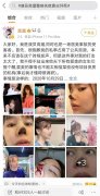 每年整形失败有多少钱(整形失败的多吗)