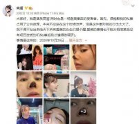 整形失败的几率是多少(整容成功概率)