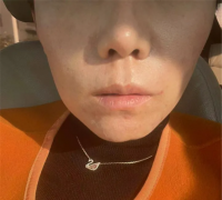 眼睛的整形需要多少钱(眼睛的整形需要多少钱呢)