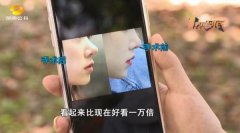 猪鼻子整形多少钱(猪鼻子整形多少钱)