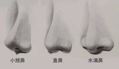 鼻唇沟整形多少钱(鼻唇沟整形手术医院)