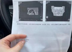 鼻部整形多少钱费用(鼻部整形需要多少钱)