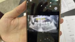 做整形牙齿多少钱(做整形牙齿多少钱一颗)