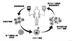 烧伤腋窝整形费用多少医保(烧伤整形医保能报销吗)