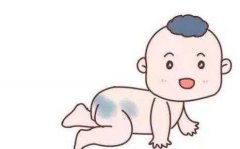 青色胎记整形医院价格多少(祛青色胎记医院)