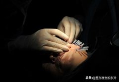 整形脸下部多少钱(面部整形大概需要多少钱)