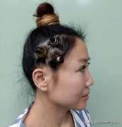 脸博士整形多少钱找专家(脸型手术整容价格)