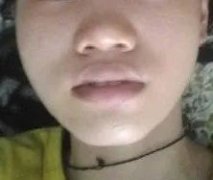 上海鼻翼整形多少钱(上海鼻翼整形多少钱)