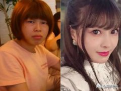 整形上颌手术多少钱(做上颌手术多少钱)