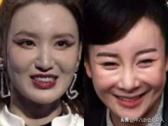 陈志朋整形隆鼻多少钱(广州整容鼻子要多少钱)