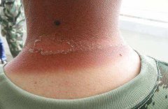 儿童物理防晒霜平价品牌(儿童防晒霜哪款好用)